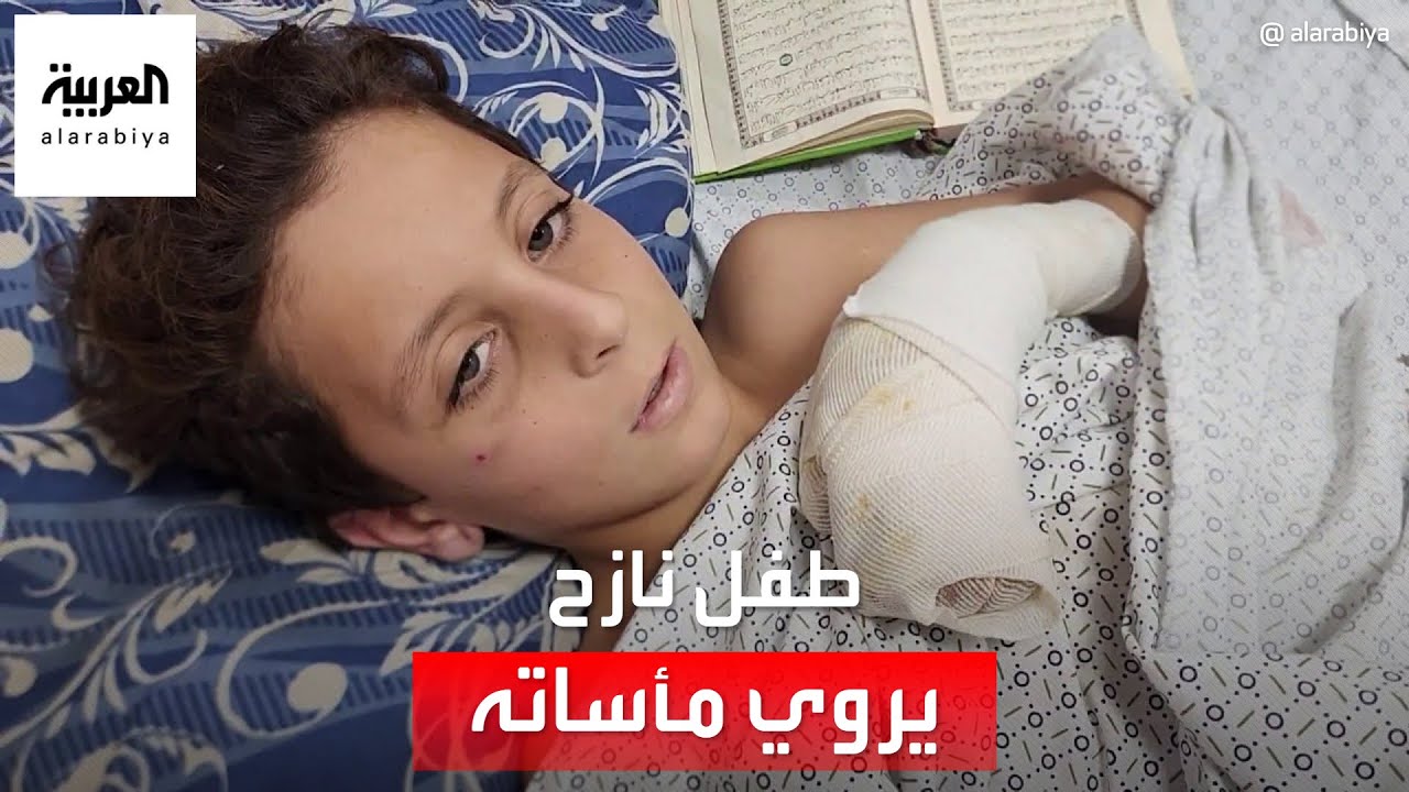 طفل نازح في غزة يروي قصة إصابة قدمه ويناشد المساعدة لعدم بترها