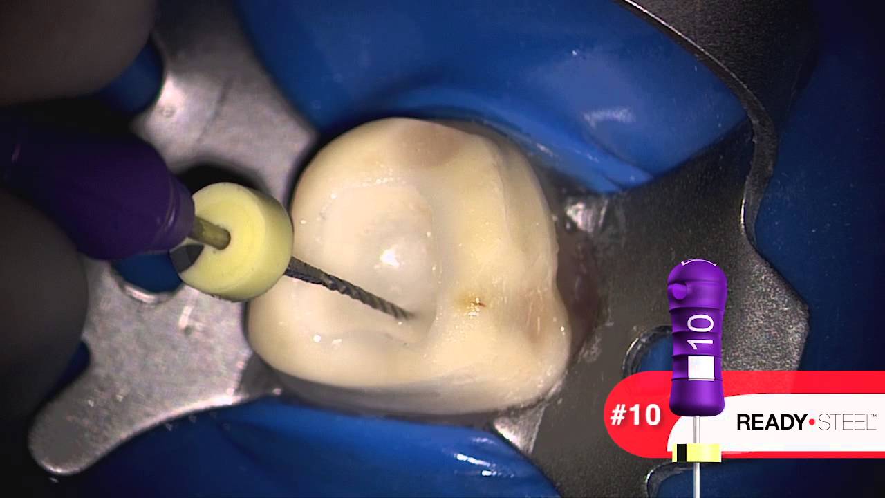 Protaper Next® with Proglider®