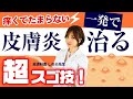 【痒くてたまらない皮膚炎】ピタっと痒みが治まる超スゴ技！薬で治らない痒みはこれで治る！