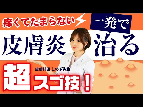 【痒くてたまらない皮膚炎】ピタっと痒みが治まる超スゴ技！薬で治らない痒みはこれで治る！