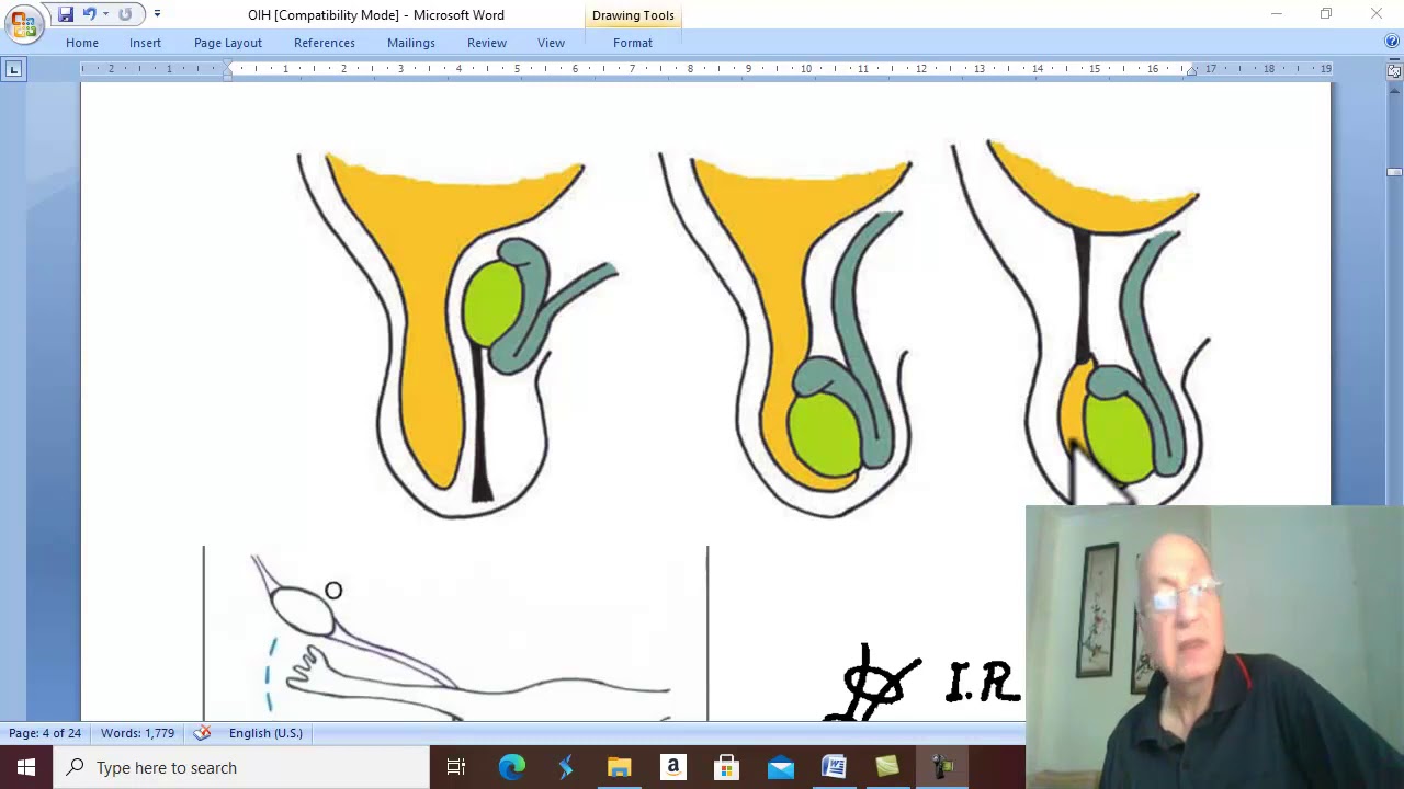 Hernia in Arabic 10 ( Indirect Inguinal hernia , part 1 ) , by Dr. Wahdan
