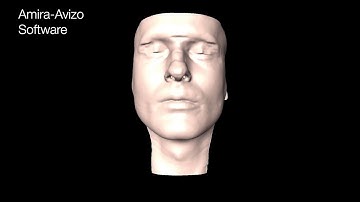 Upper airway flow analysis in correlative rhinosurgery research with Amira Software
