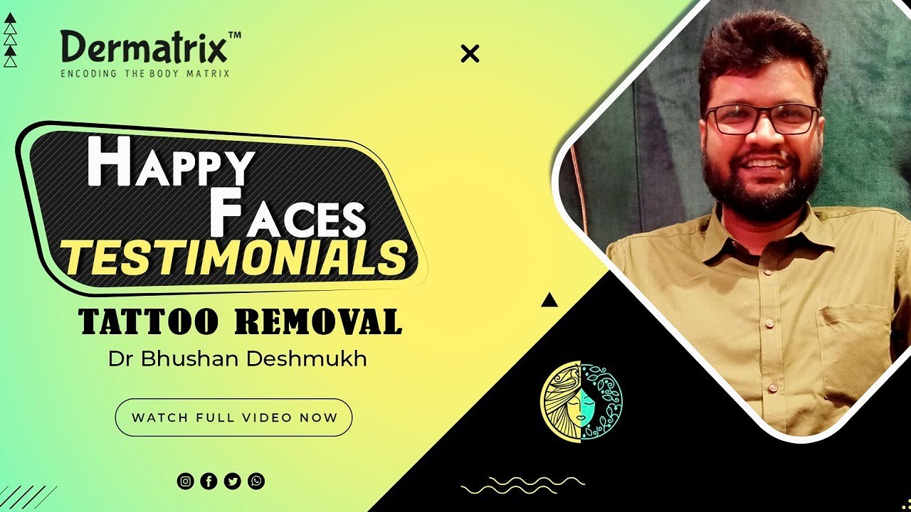 Top Tattoo Removal in Kalyan West, Mumbai - Best Permanent Tattoo Removal -  Justdial
