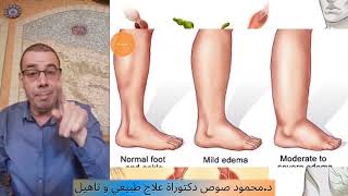 كيفية تنظيف الجهاز اللمفاوي والجهاز التنفسي/How to clean your lymphatic and respiratory system