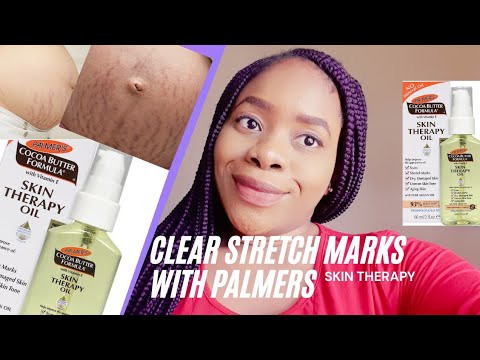 Palmers Cocoa Butter, Coconut Oil, and Other Natural Ingredient