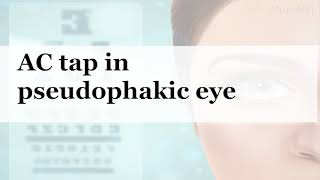 Anterior Chamber tap in pseudophakic eye