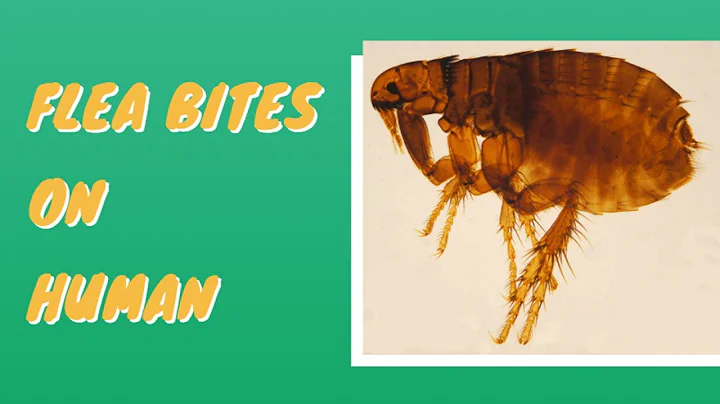 Flea Bites vs Bed Bug Bites: How to Tell the Difference