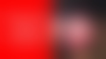 Open Heart Surgery Simulation