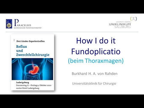 Prof. von Rahden HOW I DO IT Fundoplikatio (beim Thoraxmagen)