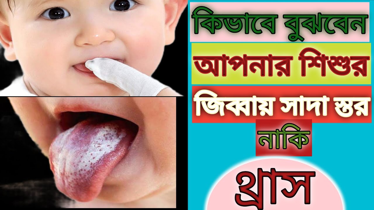 How To Clean Newborn Baby Tongue & Mouth in Bengali Tips to Clean Baby Tongue জিহ্বা পরিষ্কার