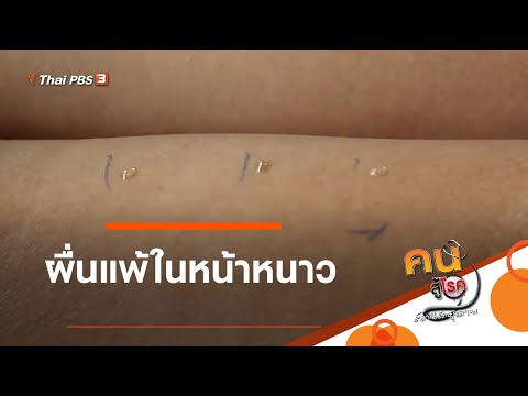 ผื่นแพ้ในหน้าหนาว : รู้สู้โรค (19 ม.ค. 64)