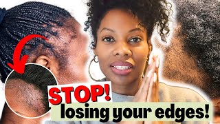 Grow Your EDGES BACK! Fast Thicker With This Regimen - How To Treat Traction Alopecia! Net Worth
