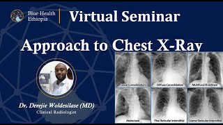 Approach to Chest X-Ray by Dr Derejie Woldesilasie  | Blue Health Ethiopia | Virtual Seminar screenshot 4