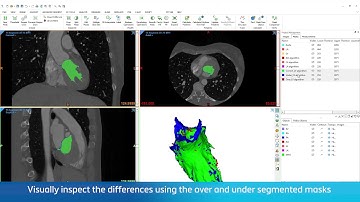 Compare Masks | Mimics Innovation Suite 24
