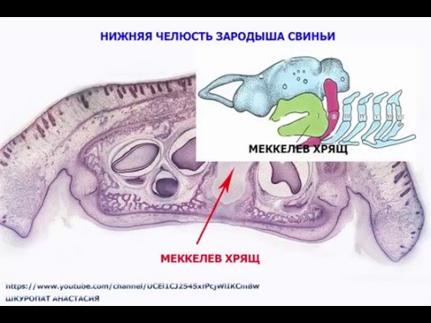 Гистологический препарат "Развитие кости из мезенхимы"