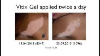 Vitix Gel