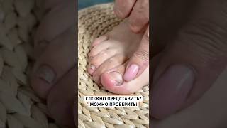 Заказать Микозоцид можно на Wildberries.Артикул -450824076