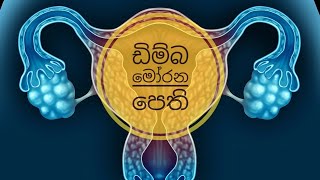 මොනවද මේ ඩිම්බ මෝරන පෙති ?|ovulation induction drugs|Mr MLT|2021 screenshot 2