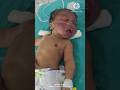 face presentation baby#shick baby#new born baby