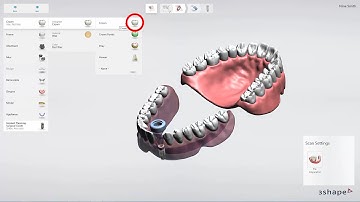 3Shape Implant Studio 2015 - How to get started?