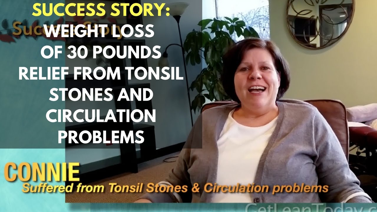 Success Weight Loss of 30 pounds, Relief from Tonsil Stones YouTube