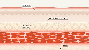 How Light Therapy Works To Treat Pain