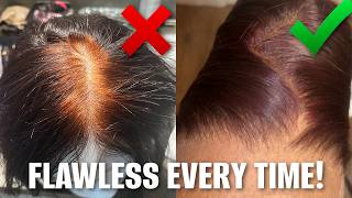 Wigs 101: How To PERFECTLY Bleach &amp; Pluck Your Knots | Beginner Friendly 