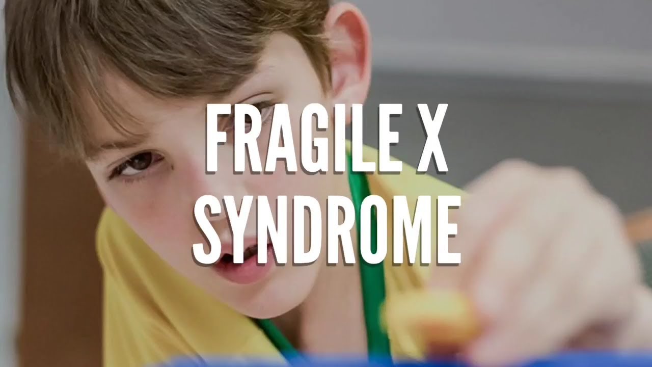 What Is Fragile X Syndrome Youtube