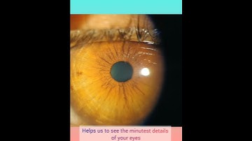 Slit lamp Microscope| Ever wondered what Ophthalmologists see through flashing lights in your eyes?