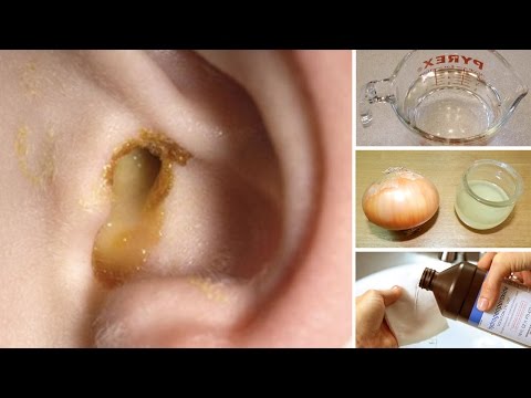 6 Best Home Remedies For Getting Rid Of Swimmer's Ear