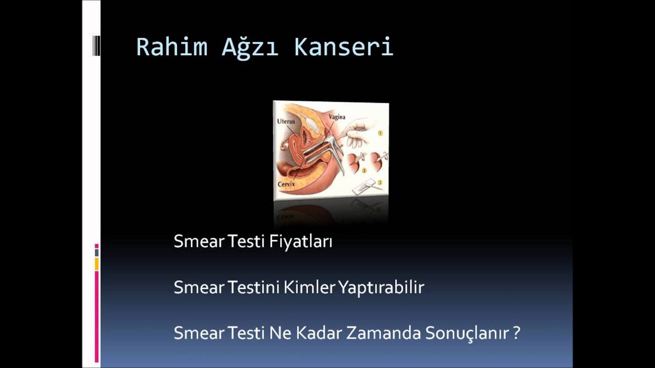 Pap smear testi nedir Pap smear testi nedir