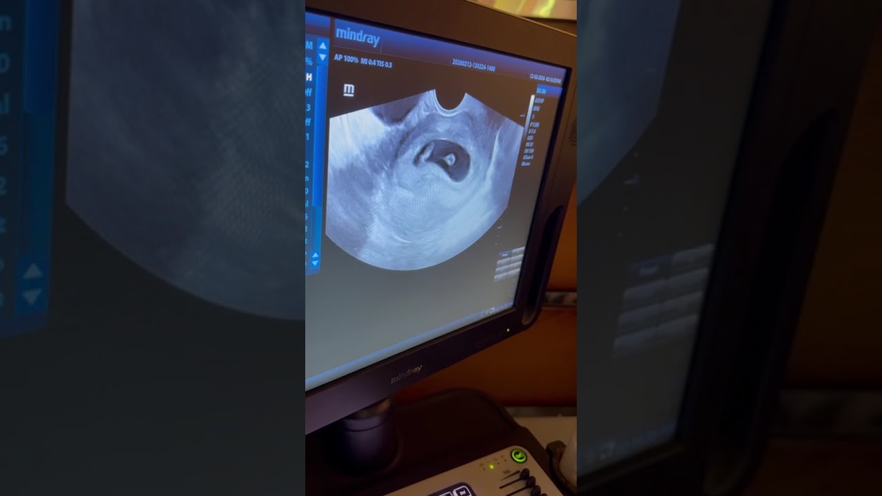 رحلة مع الجنين