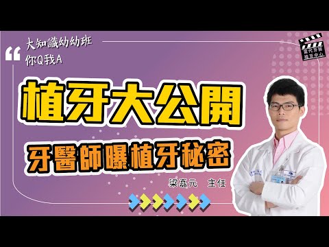 【你Q我A】植牙祕密大公開，這些眉角告訴你❗️ EP2