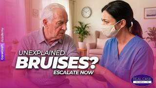 Are You Escalating Unexplained Bruising? Safeguarding Training