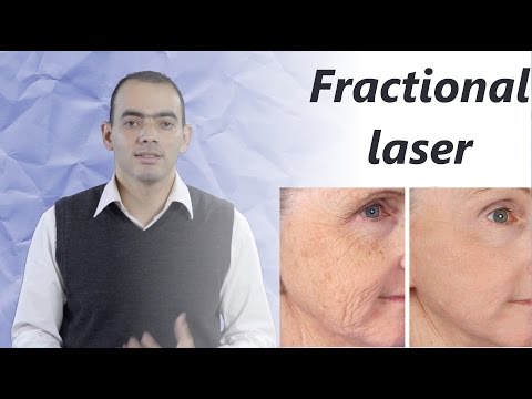 فراكشنال ليزر د محمد الناظر