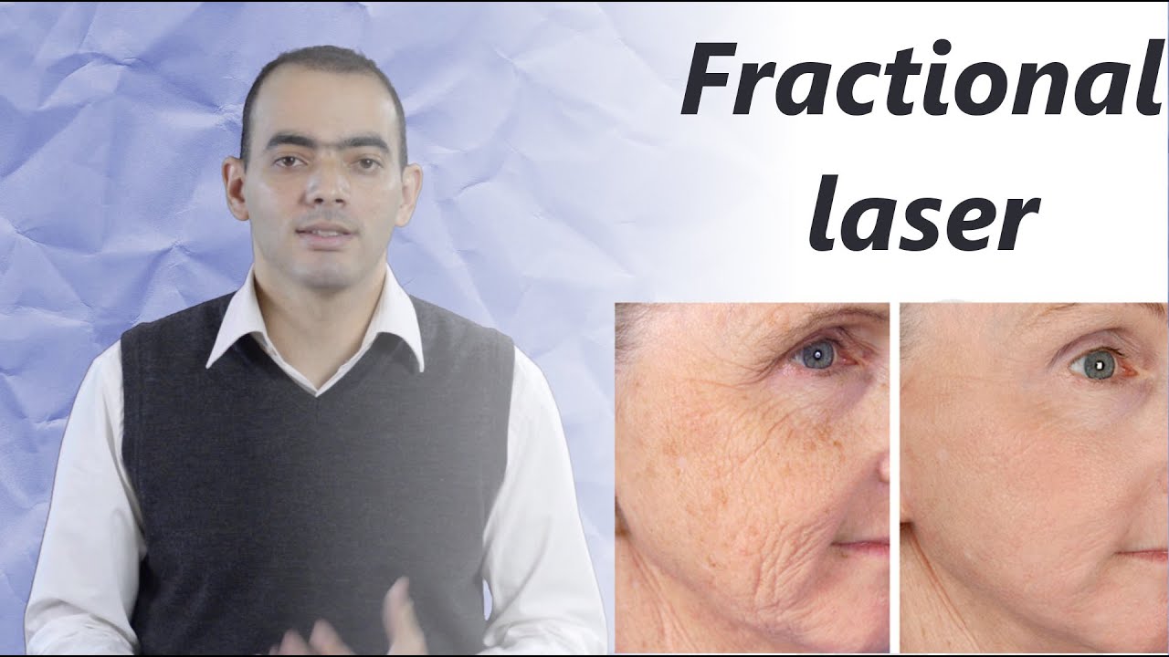فراكشنال ليزر - د. محمد الناظر