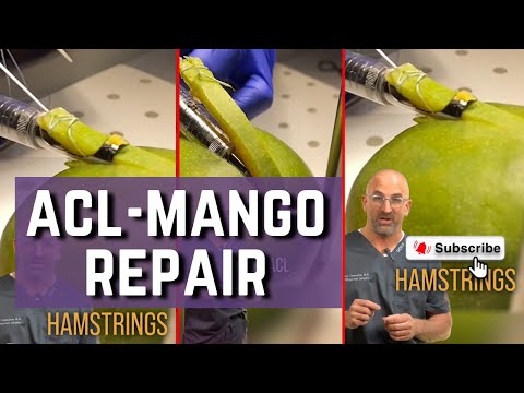 ACL Repair with Hamstring Tendon #shorts