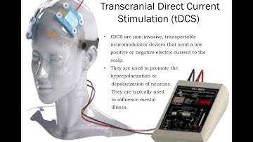 The Influences of tDCS on Major Depressive Disorder