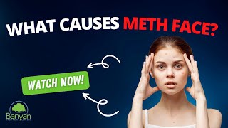What is Meth Face
