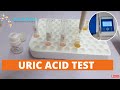 Uric Acid Test |  Uric Acid Test Procedure