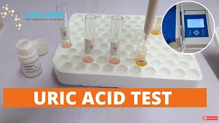 Uric Acid Test |  Uric Acid Test Procedure