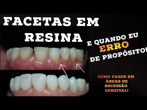 Vídeo: Qual é o propósito da rizina?