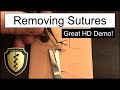 Suture tutorial how to remove sutures  best practices