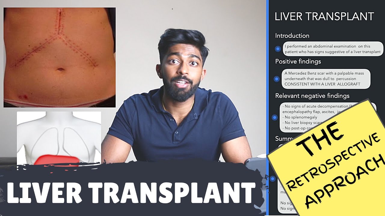 liver transplant case study assignment