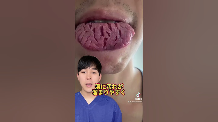 【雑学】溝状舌について解説します#Shorts