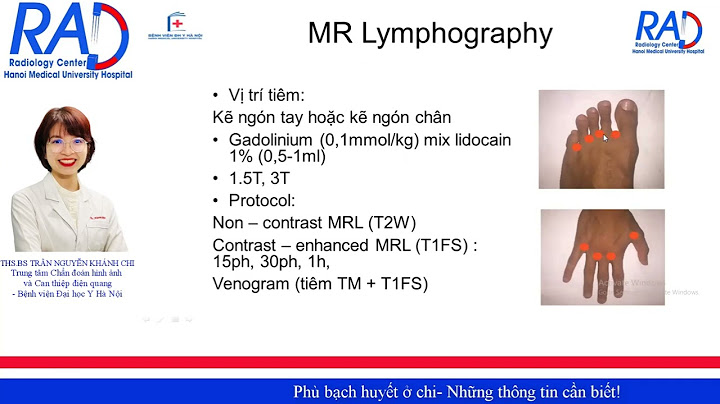 Đánh giá mức độ phù của bệnh nhân