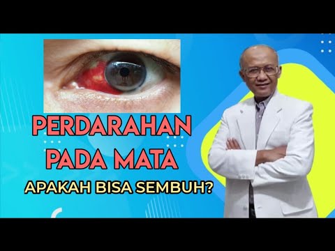 PERDARAHAN PADA MATA APAKAH BISA SEMBUH? | dr. Basuki Rokhmad SpM