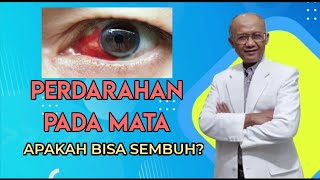 PERDARAHAN PADA MATA APAKAH BISA SEMBUH? | dr. Basuki Rokhmad SpM