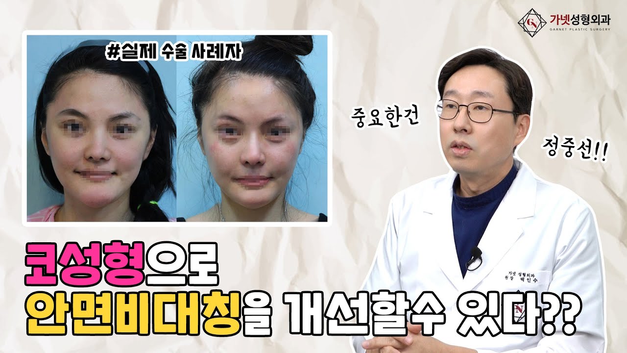 코성형으로 안면비대칭을 개선할수 있다? 코수술에서 중요한것은 정중선!!💥