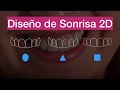 Tutorial 2 Diseño de Sonrisa 2D básico Formas dentarlas y bancos de dientes